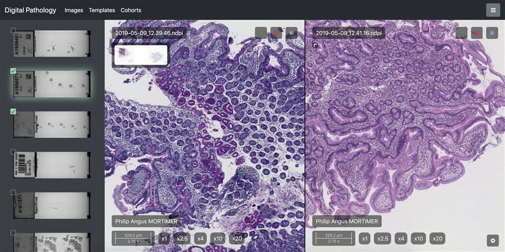 Telemis Unveils “TM-Microscopy 4.97”:  A Leap Forward Digital Pathology