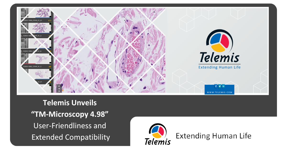 TM-Microscopy 4.98: User-friendliness and extended compatibility