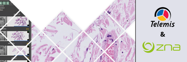 From microscope to screen: ZNA's anatomopathology lab goes digital